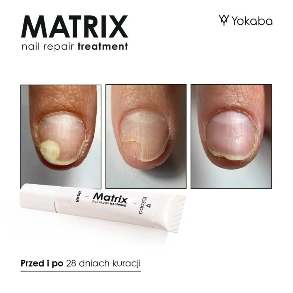 Serum regeneracyjne do paznokci Matrix Nail Repair Treatment | Yokaba
