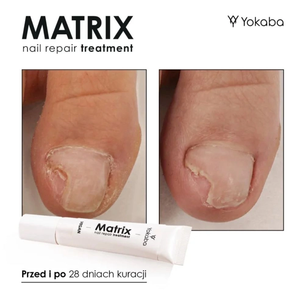 Serum regeneracyjne do paznokci Matrix Nail Repair Treatment | Yokaba